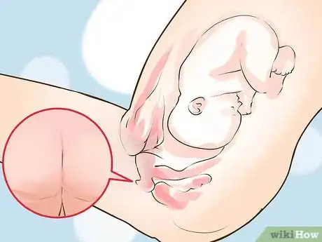 Image titled Check a Cervix for Dilation Step 13