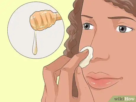 Image titled Get Rid of Blackheads Step 4