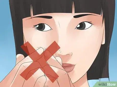 Image titled Remove Blackheads Step 19