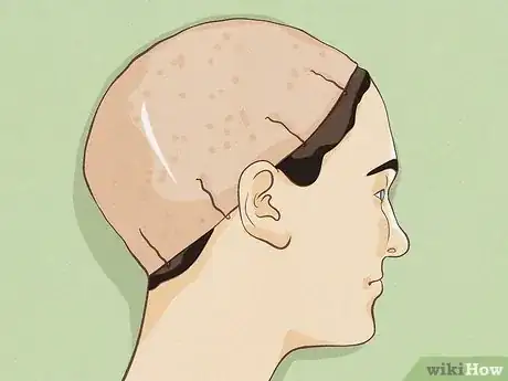 Image titled Put a Wig Cap On Step 9