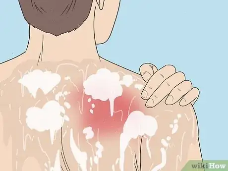 Image titled Wash Icy Hot Off Step 1