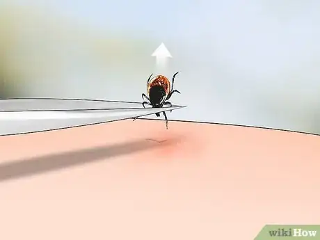 Image titled Identify Tick Bites Step 4