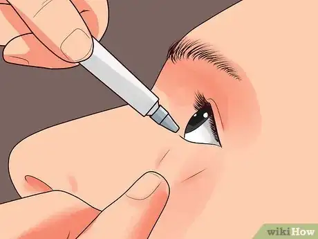 Image titled Use Erythromycin Eye Ointment Step 11