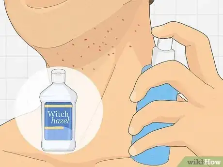 Image titled Get Rid of Razor Burn Fast Step 13