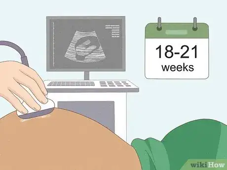 Image titled How Many Weeks Does It Take to Tell if You're Having a Boy or Girl Step 2