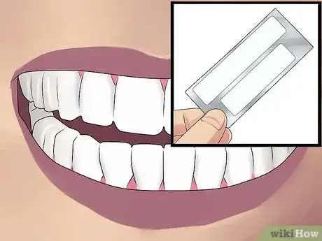 Image titled Get Perfect Teeth Step 11