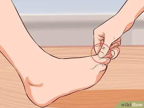 Image titled Use Acupressure to Induce Labour Step 3