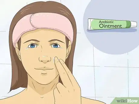 Image titled Heal Your Face After Picking Step 3