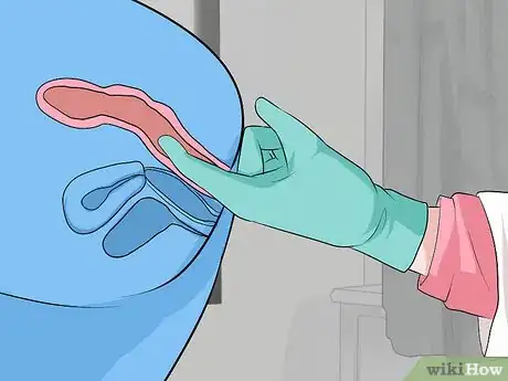 Image titled Detect Appendicitis During Pregnancy Step 13