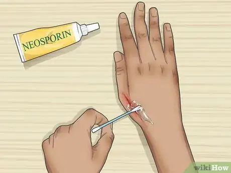 Image titled Apply Neosporin Step 6