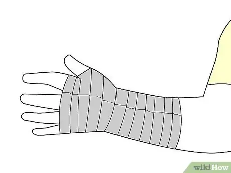 Image titled Wrap a Wrist Step 19