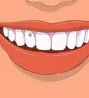 Apply Tooth Gems