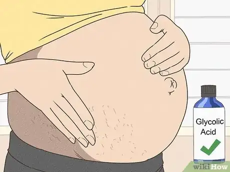 Image titled Minimize Stretch Marks During Pregnancy Step 11