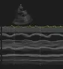 Interpret Echocardiograms