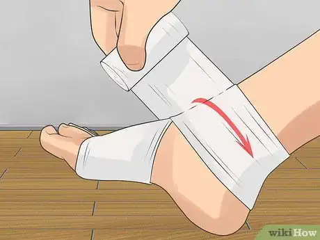 Image titled Recover From a Foot Injury Step 5