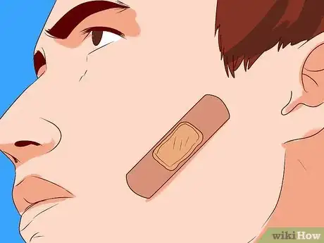 Image titled Get a Skin Tag Removed by a Doctor Step 5