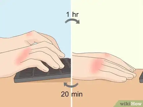 Image titled Fix Knuckle Pain Step 1