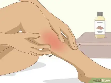 Image titled Get Rid of Leg Pain Step 6