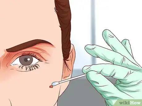 Image titled Get a Skin Tag Removed by a Doctor Step 2