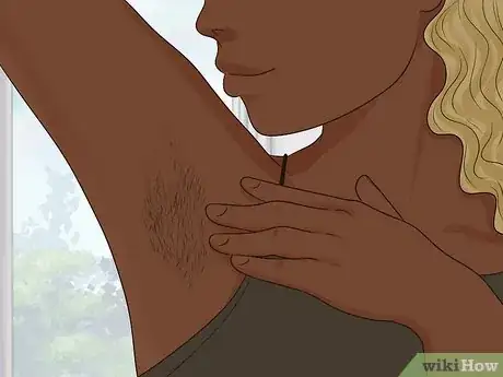 Image titled Remove an Ingrown Hair Step 14