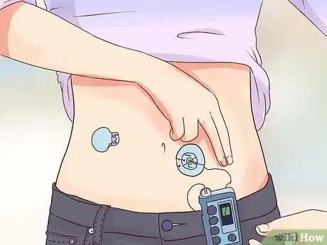 Image titled Sleep With an Insulin Pump Step 5