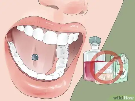 Image titled Stop Gum Recession Step 13