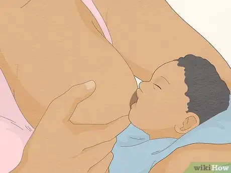 Image titled Avoid Sore Nipples While Breast Feeding Step 5