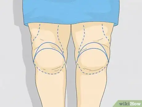 Image titled Get Rid of Knee Fat Step 11