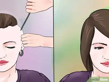 Image titled Deal With Baldness in Women Step 18