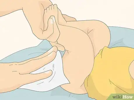 Image titled Use Coconut Oil for Diaper Rash Step 1