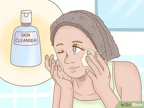 Image titled Prevent Sebaceous Cysts Step 1