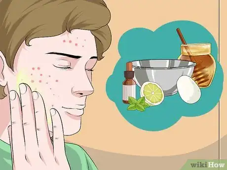 Image titled Dry Out a Pimple Step 10