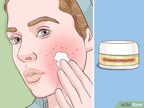 Image titled Take Care of Your Skin With Natural Methods Step 11