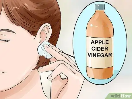 Image titled Get Rid of Pimples Inside the Ear Step 14