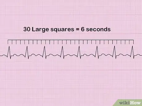 Image titled Calculate Heart Rate from ECG Step 5