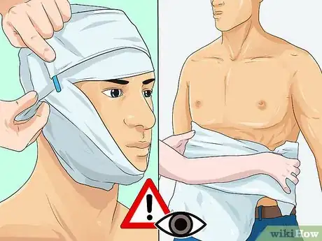 Image titled Apply a Pressure Bandage Step 11