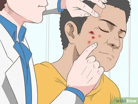 Image titled Quickly Heal Open Sores on Your Face Step 8