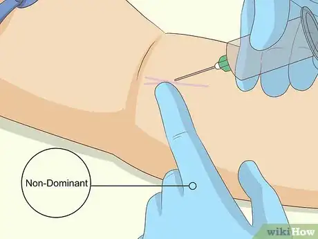 Image titled Troubleshoot a Difficult Venipuncture Step 2