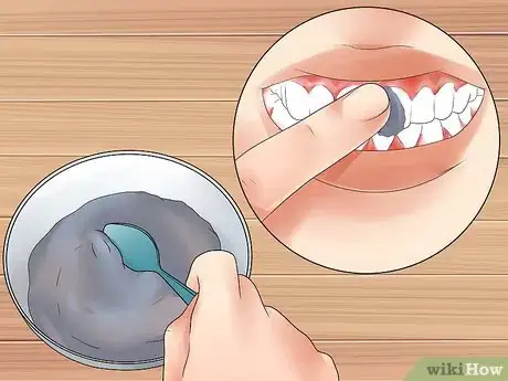 Image titled Get Rid of White Spots on Teeth Step 2