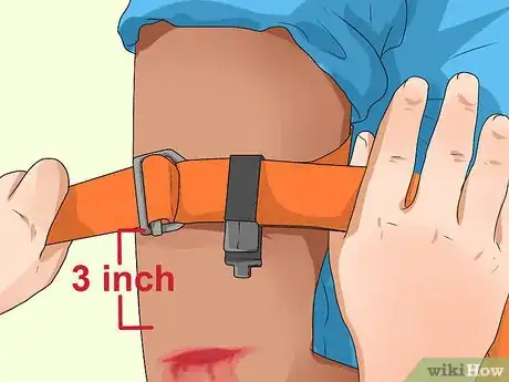 Image titled Apply a Pressure Bandage Step 12