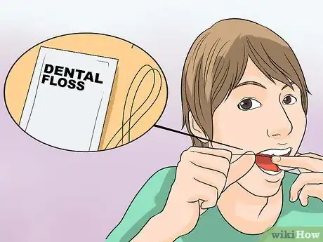 Image titled Remove Popcorn from Your Teeth Step 1