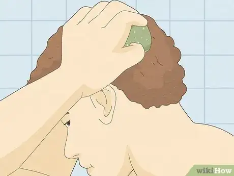 Image titled Make Your Scalp Stop Itching Step 10