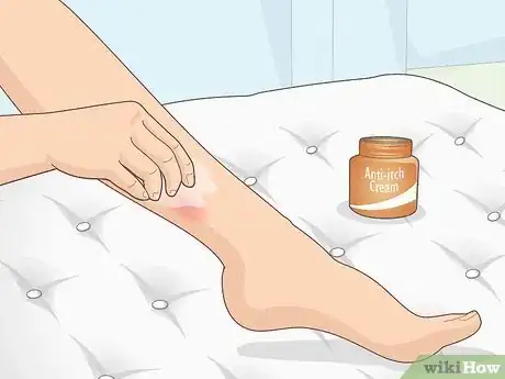 Image titled Stop Legs from Itching Step 3