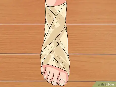 Image titled Tape a Foot for Plantar Fasciitis Step 4