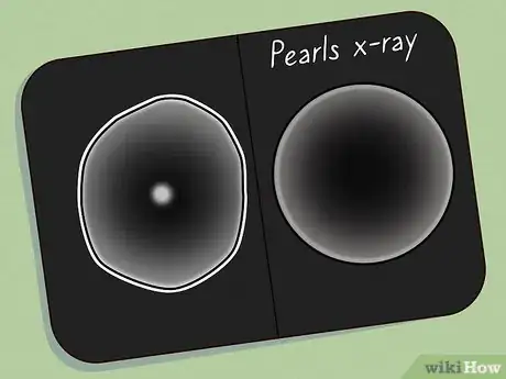 Image titled Identify Pearls in Vintage Jewelry Step 10