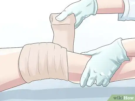 Image titled Know if You Have a Baker's Cyst Step 11