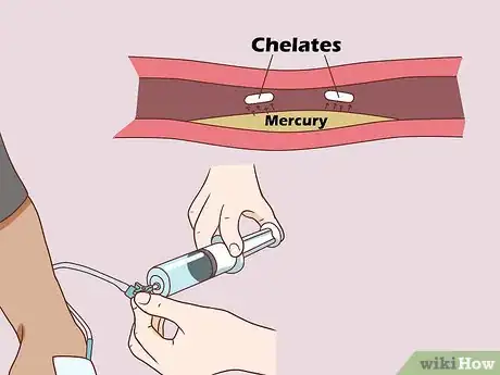 Image titled Remove Mercury from the Body Step 3