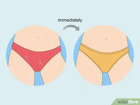 Image titled Stop Vaginal Itching Step 10