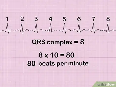 Image titled Calculate Heart Rate from ECG Step 7