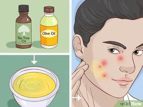 Image titled Take Care of Your Skin With Natural Methods Step 12